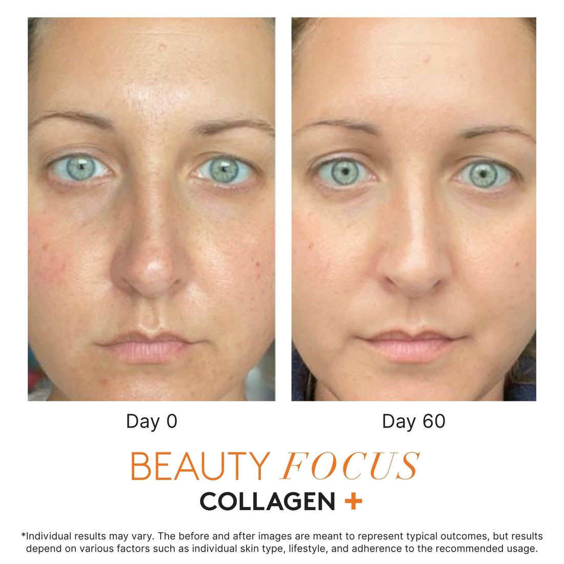 How Do I Create a Nu Skin Customer Account for Free?